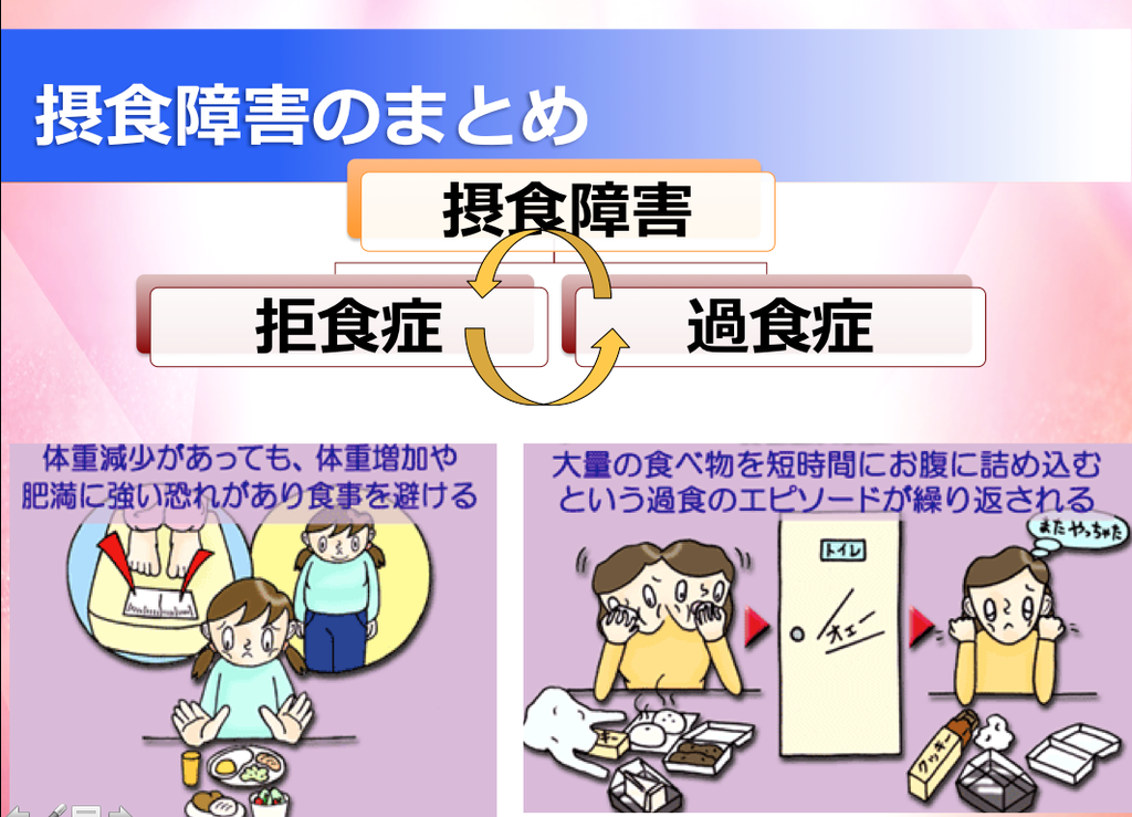 神経性過食症の見通しはどうなりますか?